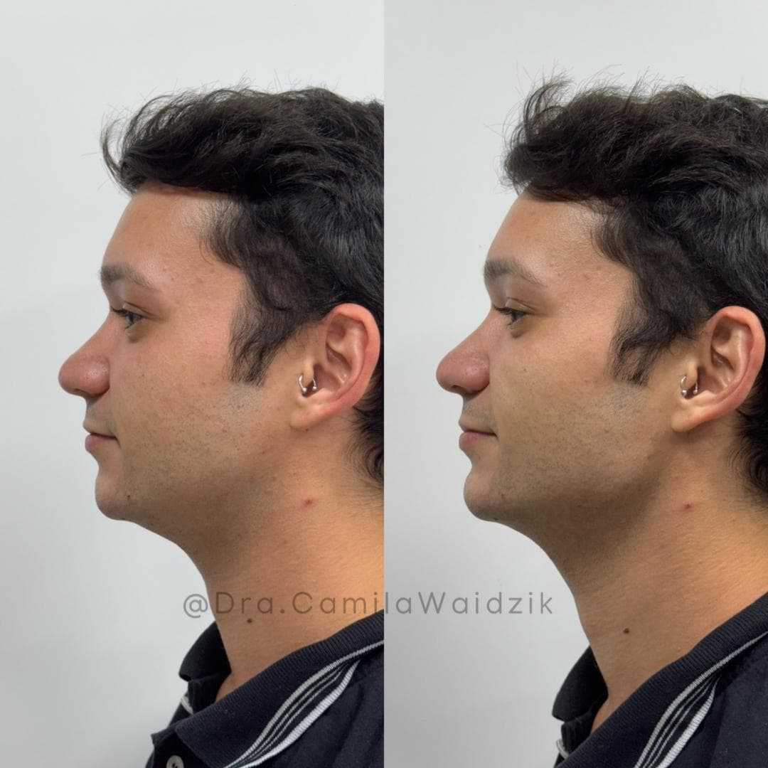 Harmonia natural — caso real Instituto Areluna