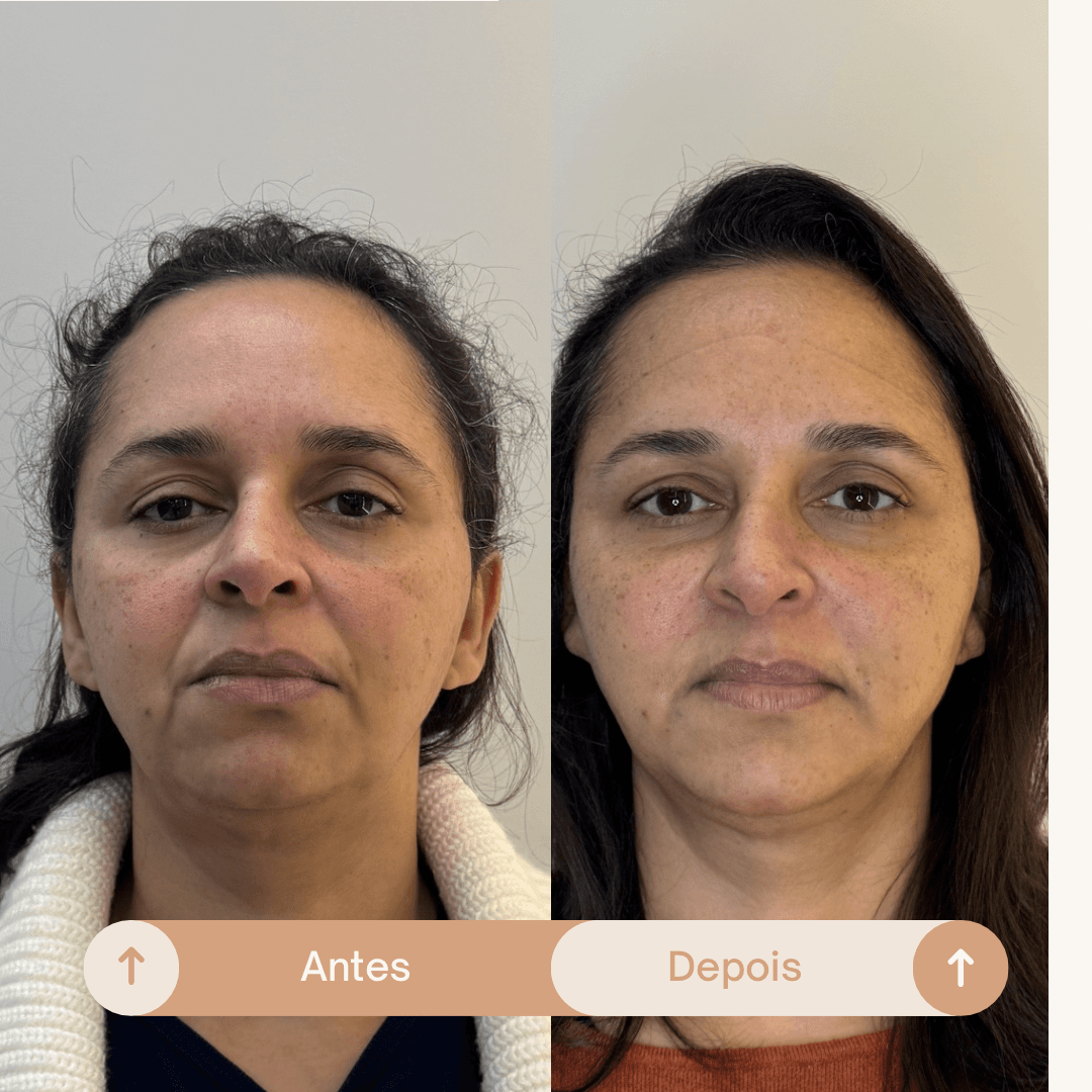Olhar descansado — caso real Instituto Areluna